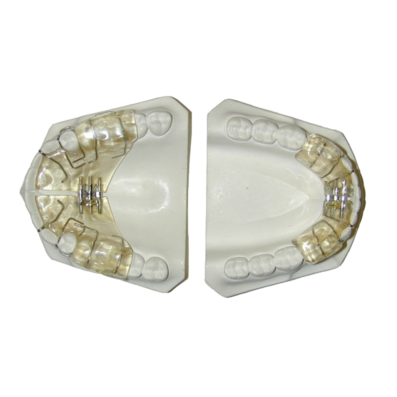 occlusal स्प्लिंटच्या कृतीची यंत्रणा