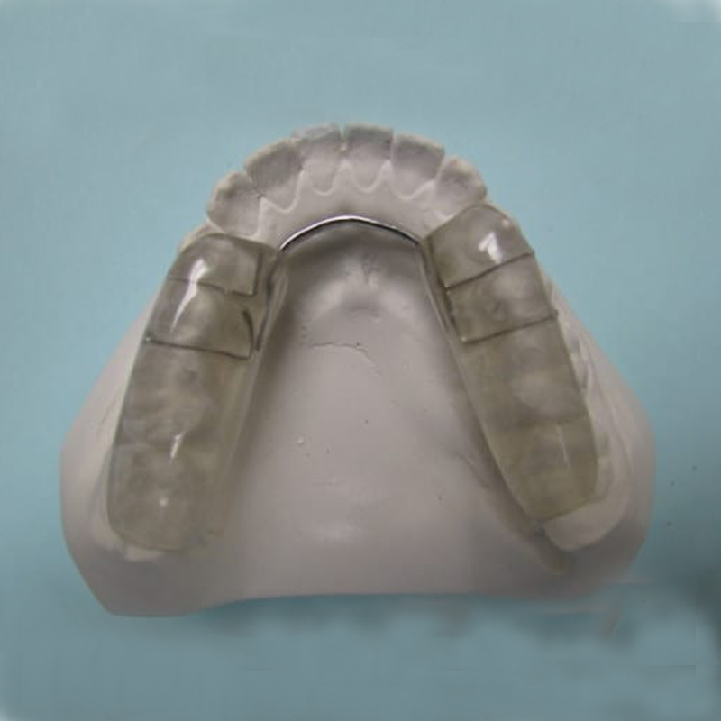 स्थिर occlusal स्प्लिंटचा परिचय आणि संकेत
