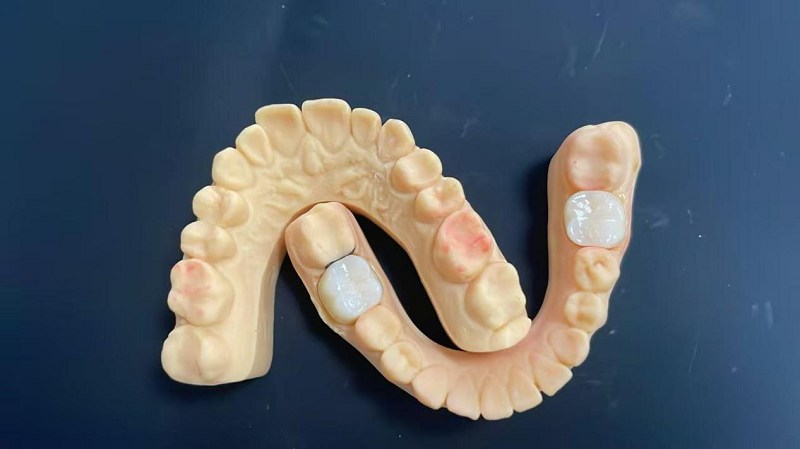 खांद्याची किनार काय आहे?