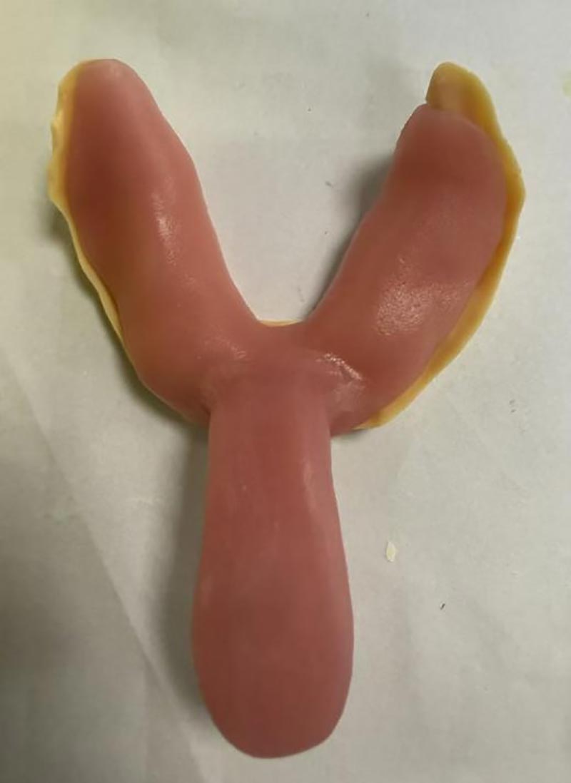 सानुकूल दंत ट्रे बद्दल आपल्याला माहित नसलेल्या गोष्टी